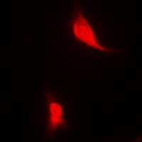 Anti-EGLN1 Antibody