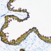 Anti-RRM1 Antibody
