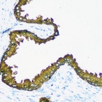 RRM1 antibody