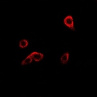 Anti-RRM1 Antibody