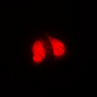 Anti-GGA2 Antibody