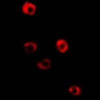 Anti-Tropomyosin 3 Antibody