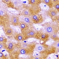 Anti-SHMT2 Antibody