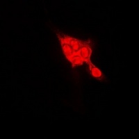 Anti-SELENBP1 Antibody