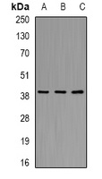 AKR7A2 Antibody