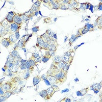 CARD4 Rabbit Polyclonal Antibody
