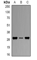 HLA-DPB1 Rabbit Polyclonal Antibody
