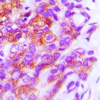 Anti-HLA-DPB1 Antibody