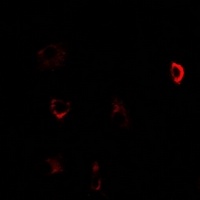 Anti-CBS Antibody