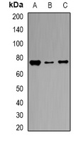 Transferrin Rabbit Polyclonal Antibody