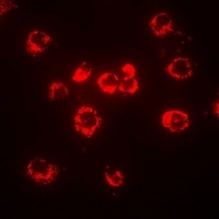 TLR8 antibody