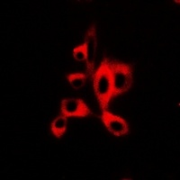 Anti-AdipoR1 Antibody