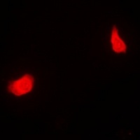 PSMC5 Antibody