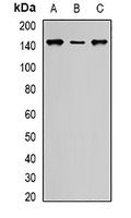 SIN3A Rabbit Polyclonal Antibody