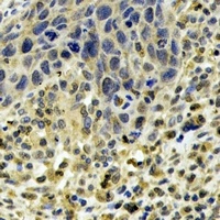 Anti-ABO Antibody