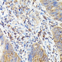 Anti-TAP2 Antibody