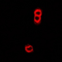 Anti-TAP2 Antibody