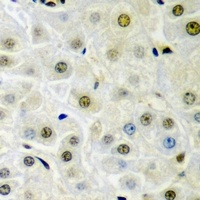 Anti-Dysbindin 1 Antibody