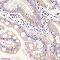Anti-HMGCR Antibody