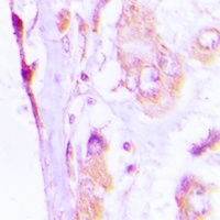 Anti-CAP18 Antibody