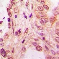 Anti-SF2 Antibody