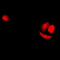 Anti-SF2 Antibody