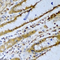 Anti-beta-TrCP Antibody