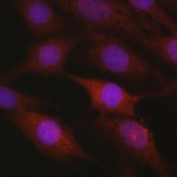 Anti-beta-TrCP Antibody