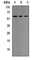 GNT1 Rabbit Polyclonal Antibody