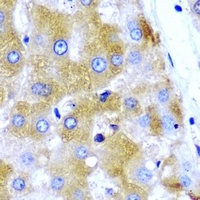 UGT1A9 antibody