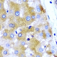 Anti-GNT1 Antibody