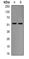 Alpha-galactosidase A Rabbit Polyclonal Antibody