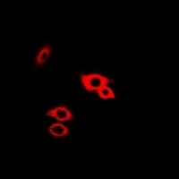 Alpha-galactosidase A Rabbit Polyclonal Antibody