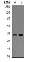 XBP1 Rabbit Polyclonal Antibody