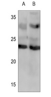 Frataxin Antibody