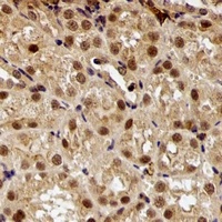 Anti-E6AP Antibody