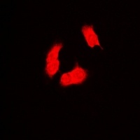 Anti-PSMB9 Antibody