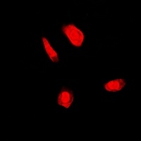 Anti-FANCC Antibody