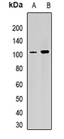 RPGR Antibody