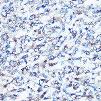 Anti-Optineurin Antibody