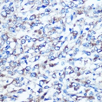 OPTN antibody