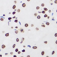 Ikaros Rabbit Polyclonal Antibody