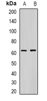 CES1 Rabbit Polyclonal Antibody