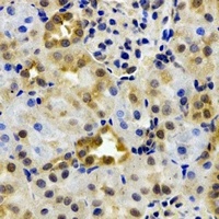 Anti-EPHX2 Antibody