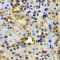 EPHX2 antibody