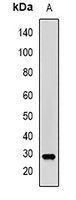 PGD2 synthase Rabbit Polyclonal Antibody