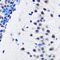 Anti-Reptin 52 Antibody