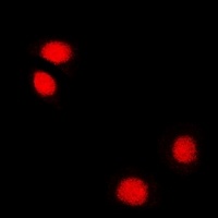 Anti-Reptin 52 Antibody
