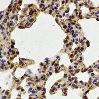Anti-PADI4 Antibody
