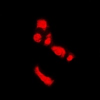 Anti-PADI4 Antibody